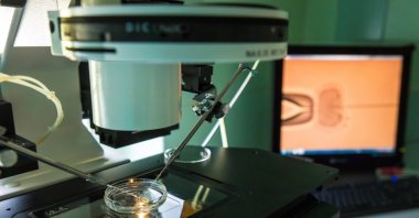 Artificial insemination in vitro-fertilization in a laboratory. (Shutterstock Photo)