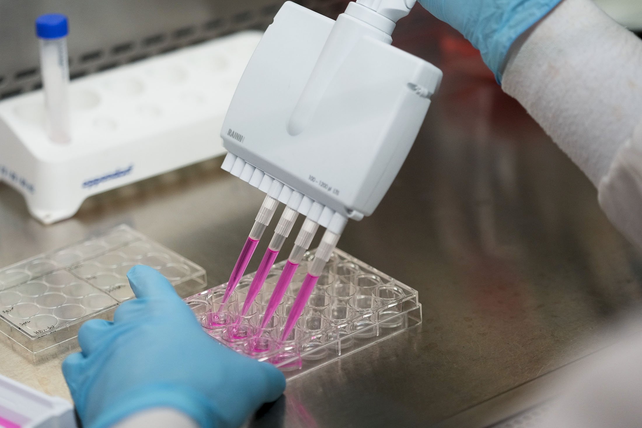 Seorang ilmuwan penelitian menggunakan pipet multisaluran untuk memisahkan sel kanker ovarium dengan enzim trypsin di Cancer Vaccine Institute UW Medicine, di Seattle, AS, 25 Mei 2023. (Foto AP)