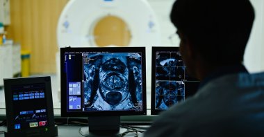 A doctor checks MRI images of a patient, in Heidelberg, Germany. (dpa Photo)