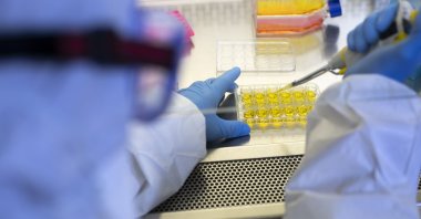 Scientists identify molecule that shows potential in targeting and eliminating cells responsible for aging. (Getty Images Photo)