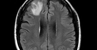 An undated handout photo received from Australian National University (ANU) shows a brain scan, Canberra, Australia, Aug. 29, 2023. (AFP Photo)