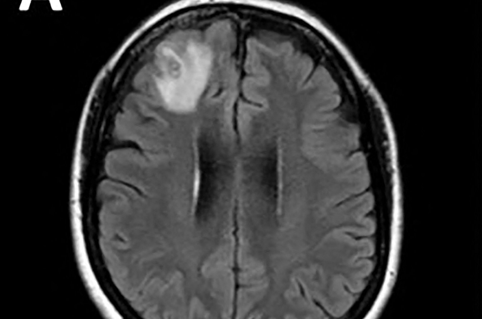 An undated handout photo received from Australian National University (ANU) shows a brain scan, Canberra, Australia, Aug. 29, 2023. (AFP Photo)