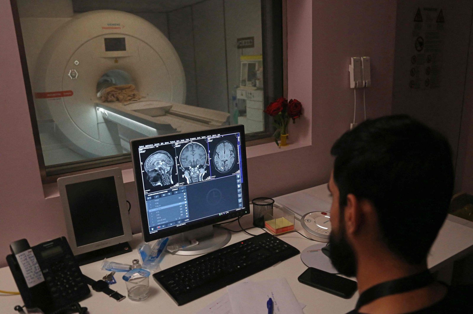 A doctor examines MRI scans for cancer diagnosis at a hospital in Karbala, Iraq, Aug. 27, 2023. (AFP Photo)