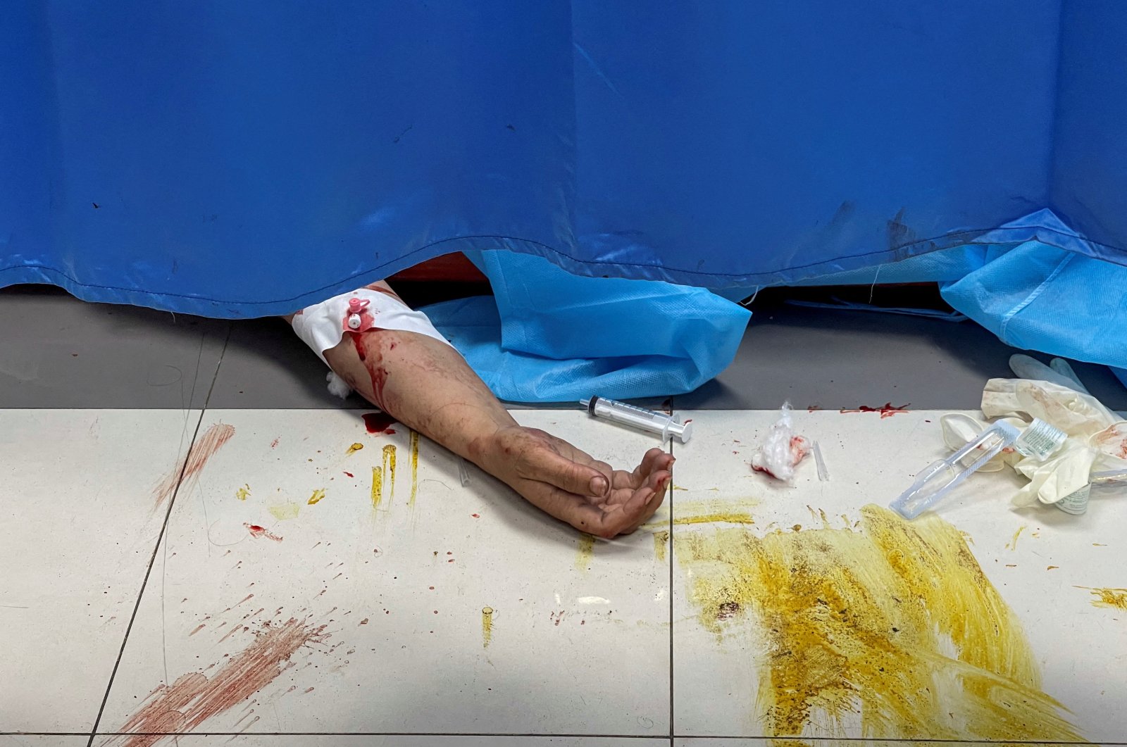 A Palestinian, who was wounded in an Israeli strike, lies on the floor at Shifa hospital in Gaza City, Oct. 15, 2023. (Reuters Photo)