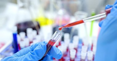 Significant treatments and studies are ongoing in the fields of vaccines, HIV prevention, containment and even complete cure. (Getty Images Photo)
