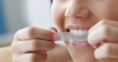 Whiting strips are a temporary way of whitening teeth. (Getty Images Photo)