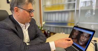 Dr. Ozan Seymen Sezen analyzing Yamayong&#039;s benign tumor, Istanbul, Türkiye, Jan. 31, 2024. (AA Photo)