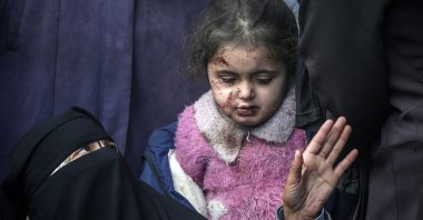 An injured Palestinian girl stands with relatives in Deir al-Balah, central Gaza Strip, Palestine, Feb. 21, 2024. (EPA Photo)