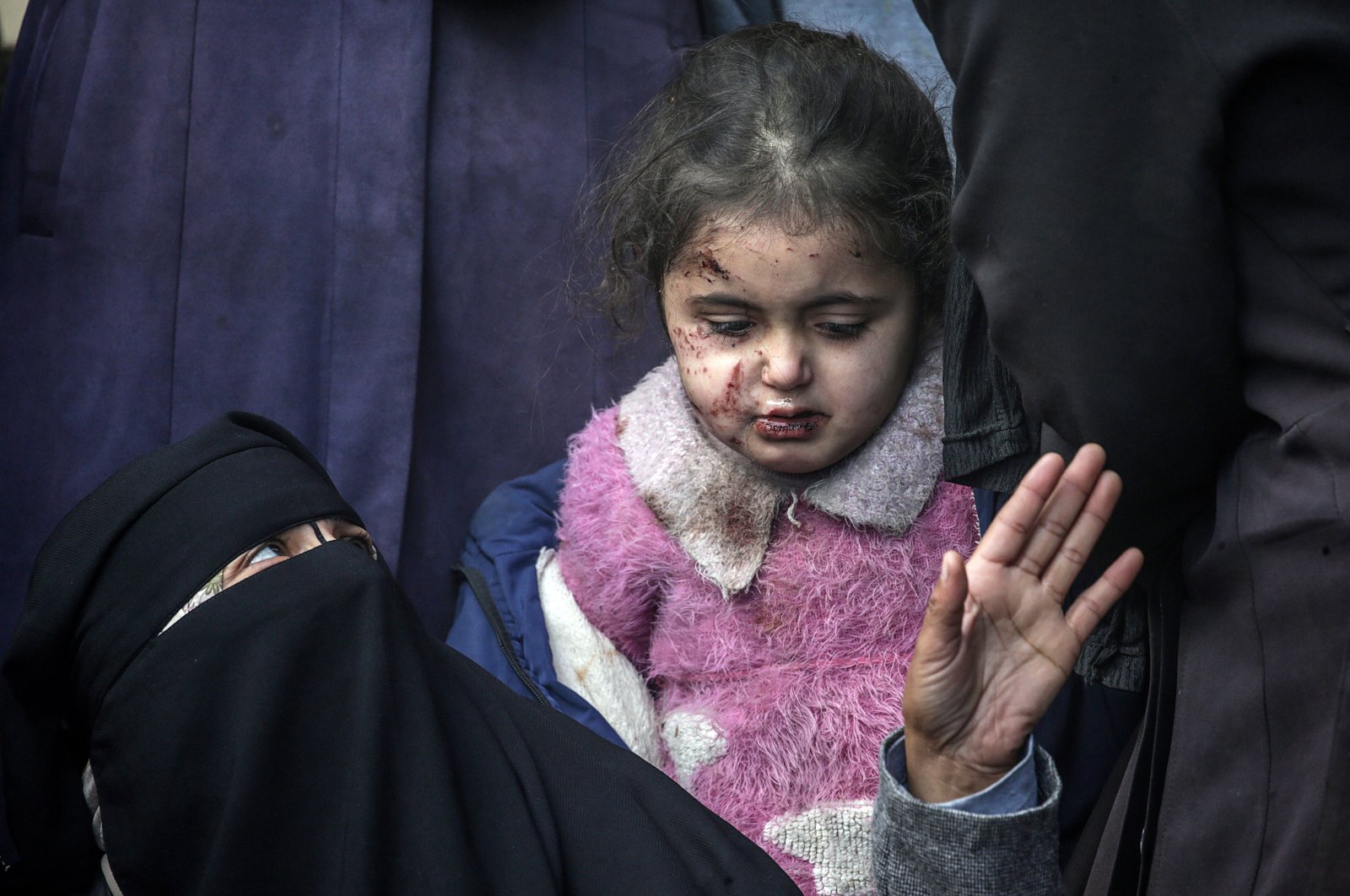 An injured Palestinian girl stands with relatives in Deir al-Balah, central Gaza Strip, Palestine, Feb. 21, 2024. (EPA Photo)