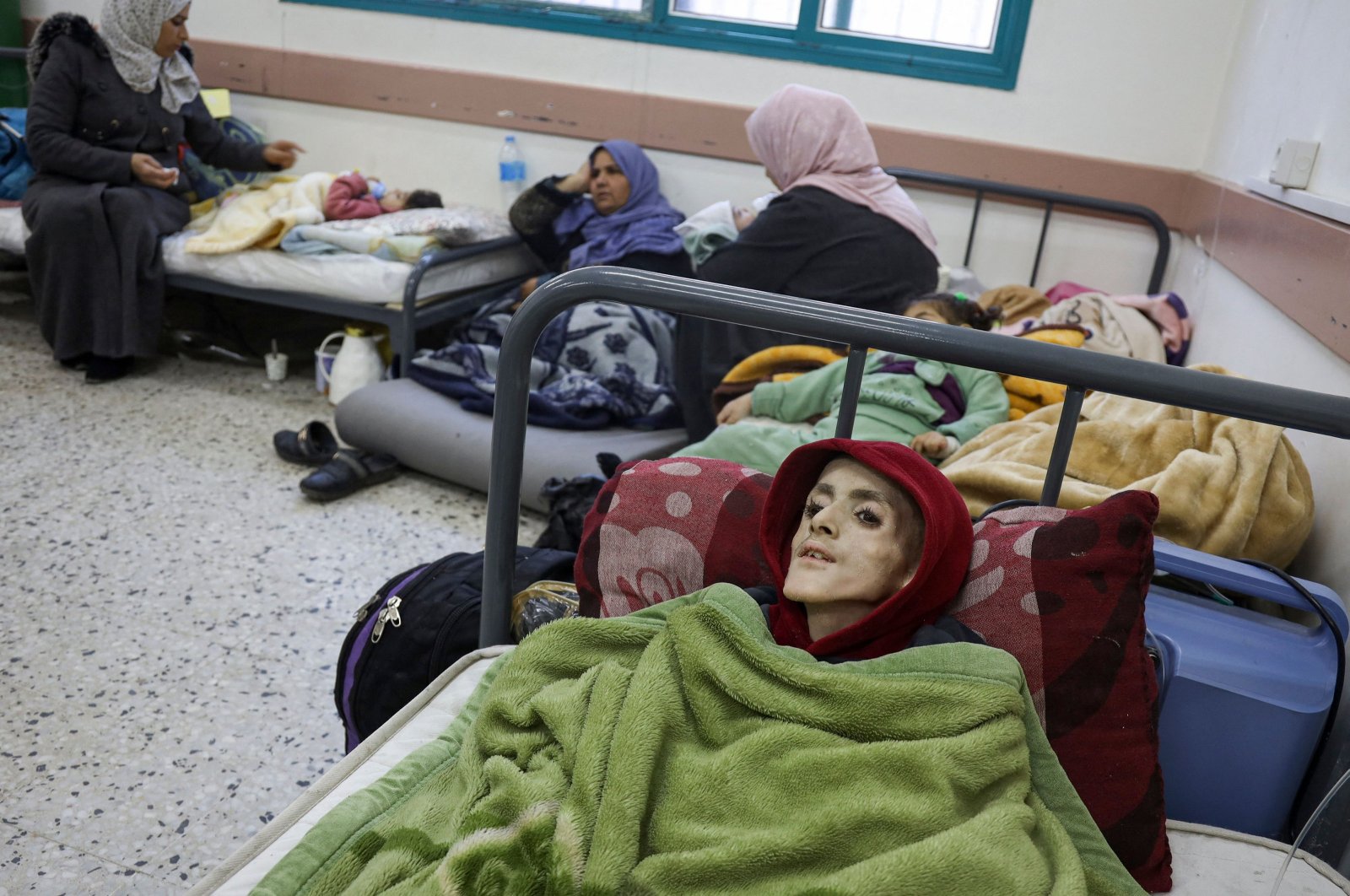 Ten-year-old Palestinian boy, Yazan al-Kafarneh, lies on a hospital bed at Al-Awda clinic in Rafah, southern Gaza Strip, Palestine, Feb. 29, 2024. (AFP Photo)