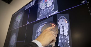 Study unveils link between dopamine, stress and time perception in the brain, Ankara University, Ankara, Türkiye, March 14, 2024. (AA Photo)