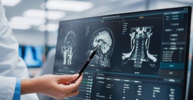 A neurologist analyzes a patient's MRI Scan at an unspecified location, May 29, 2022. (Shutterstock File Photo)