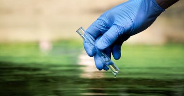 The WHO official emphasized clean water&#039;s critical role in combating cholera outbreaks. (Shutterstock Photo)