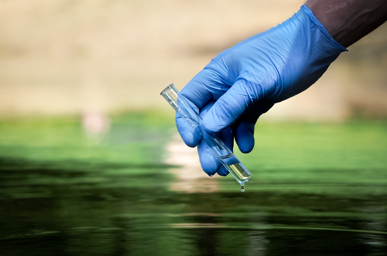 The WHO official emphasized clean water&#039;s critical role in combating cholera outbreaks. (Shutterstock Photo)