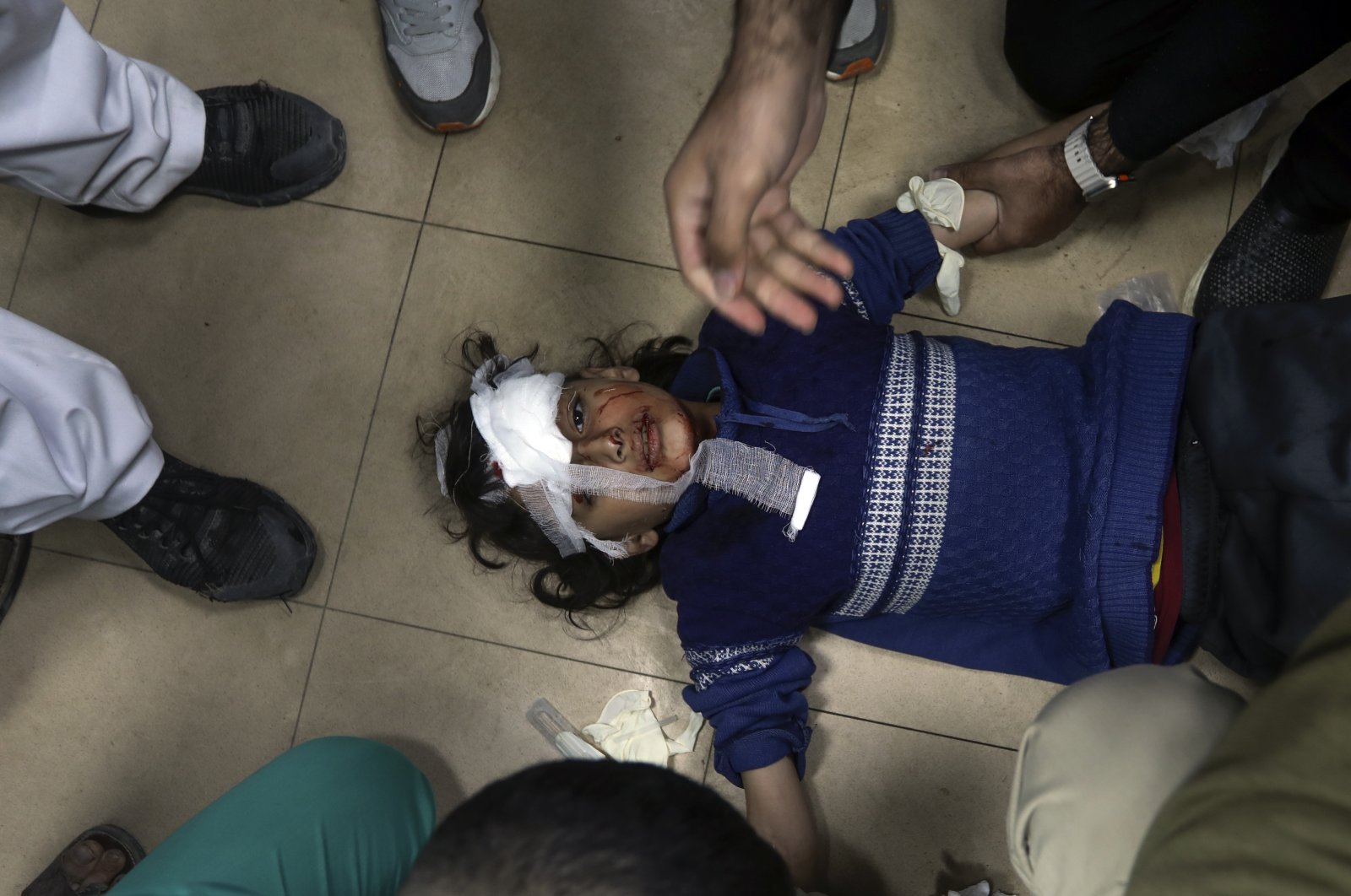 A Palestinian girl wounded in an Israeli attack is treated at the Al-Aqsa Martyrs Hospital in Deir al Balah, Gaza Strip, March 25, 2024. (AP Photo)