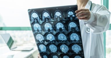 A medical doctor diagnoses neurodegenerative illness in elderly patients using MRI for neurological treatment.
(Shutterstock Photo)