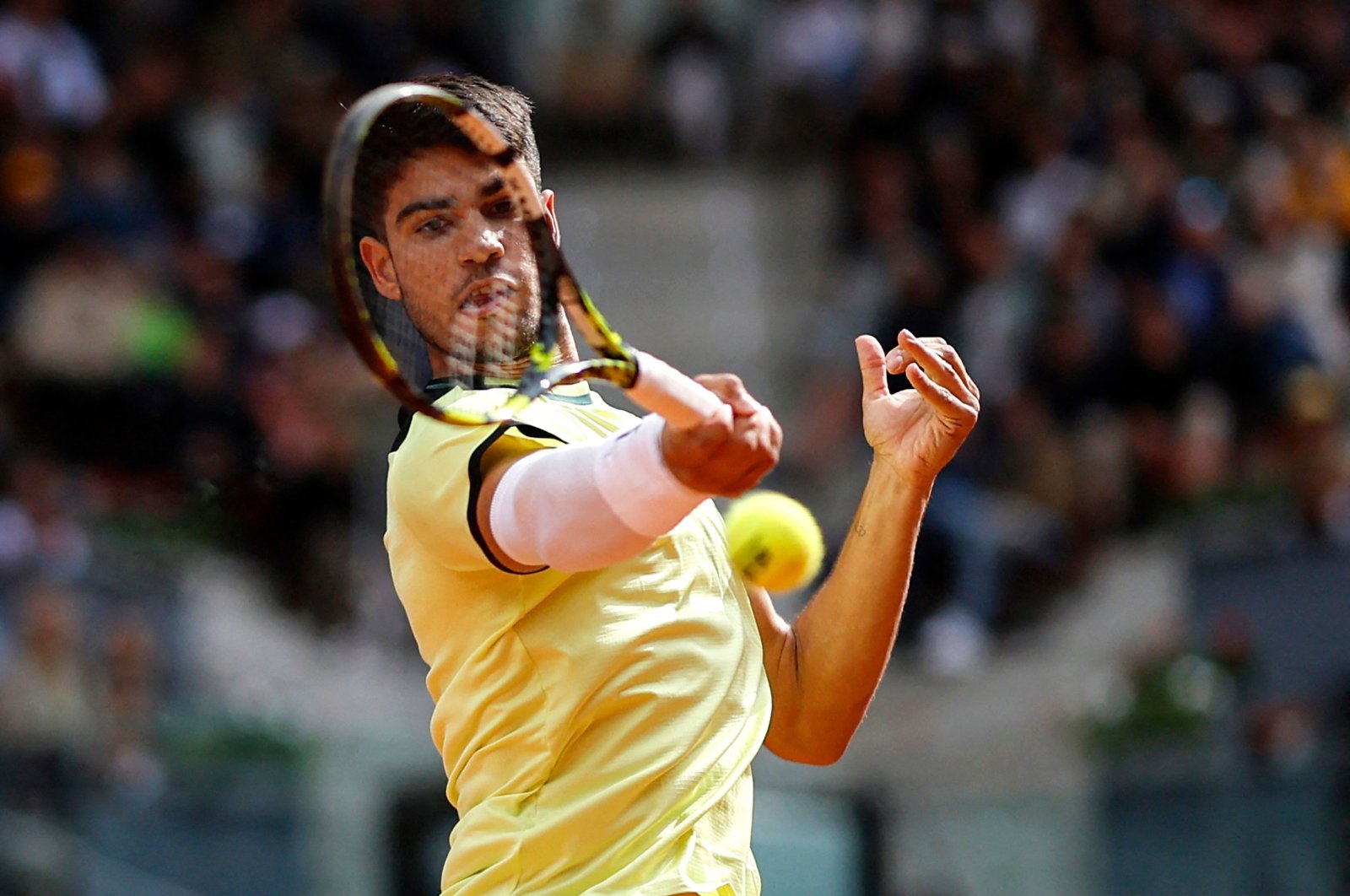 Alcaraz eases pain concerns, advances in Madrid Open