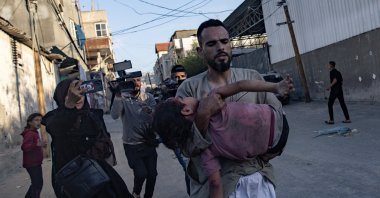 A Palestinian child injured following an Israeli strike is brought toward Al Kuwaiti Hospital in Rafah, southern Gaza Strip, May 8, 2024. (EPA Photo)