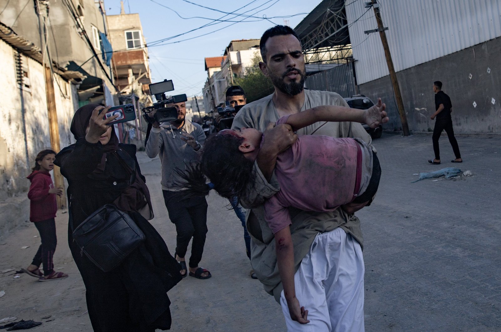 A Palestinian child injured following an Israeli strike is brought toward Al Kuwaiti Hospital in Rafah, southern Gaza Strip, May 8, 2024. (EPA Photo)