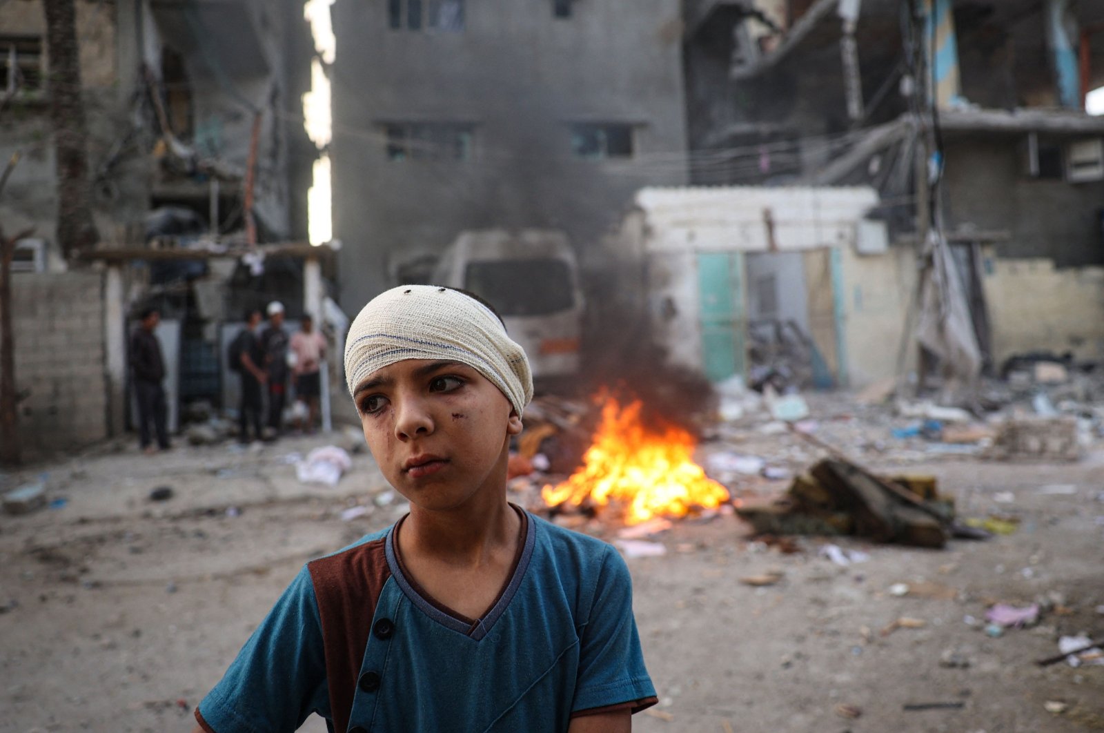 An injured Palestinian boy stands next to the rubble of a family house in Rafah, southern Gaza, Palestine, May 20, 2024. (AFP Photo)