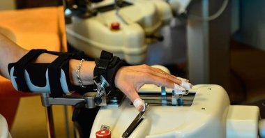 Multiple Sclerosis (MS) is a neurological condition causing cognitive impairment, weakness, numbness and vision loss. (AA Photo)