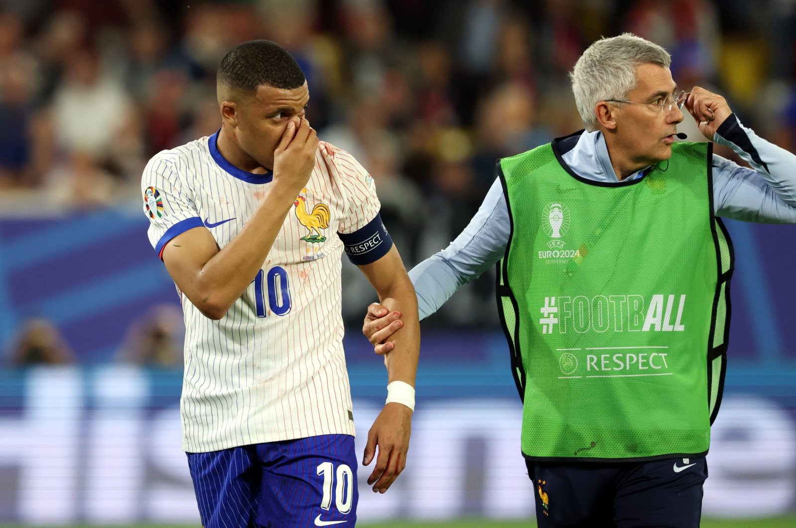 France&#039;s Kylian Mbappe (L) reacts after an injury during the Euro 2024 Group D match against Austria, Dusseldorf, Germany, June 17, 2024. (EPA Photo)