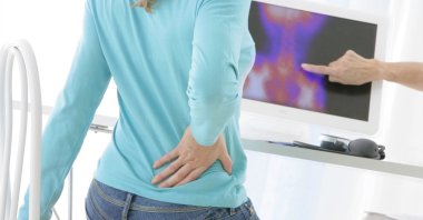 A woman is holding her back due to back pain, with an x-ray of the spinal column visible on the screen. (Getty Images)