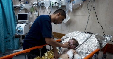 Palestinian Child Siwar Abdel-Hadi, 2, wounded in the Israeli bombardment of the Gaza Strip, receives medical treatment at a hospital, Deir al-Balah, Palestine, July 24, 2024. (AP Photo)