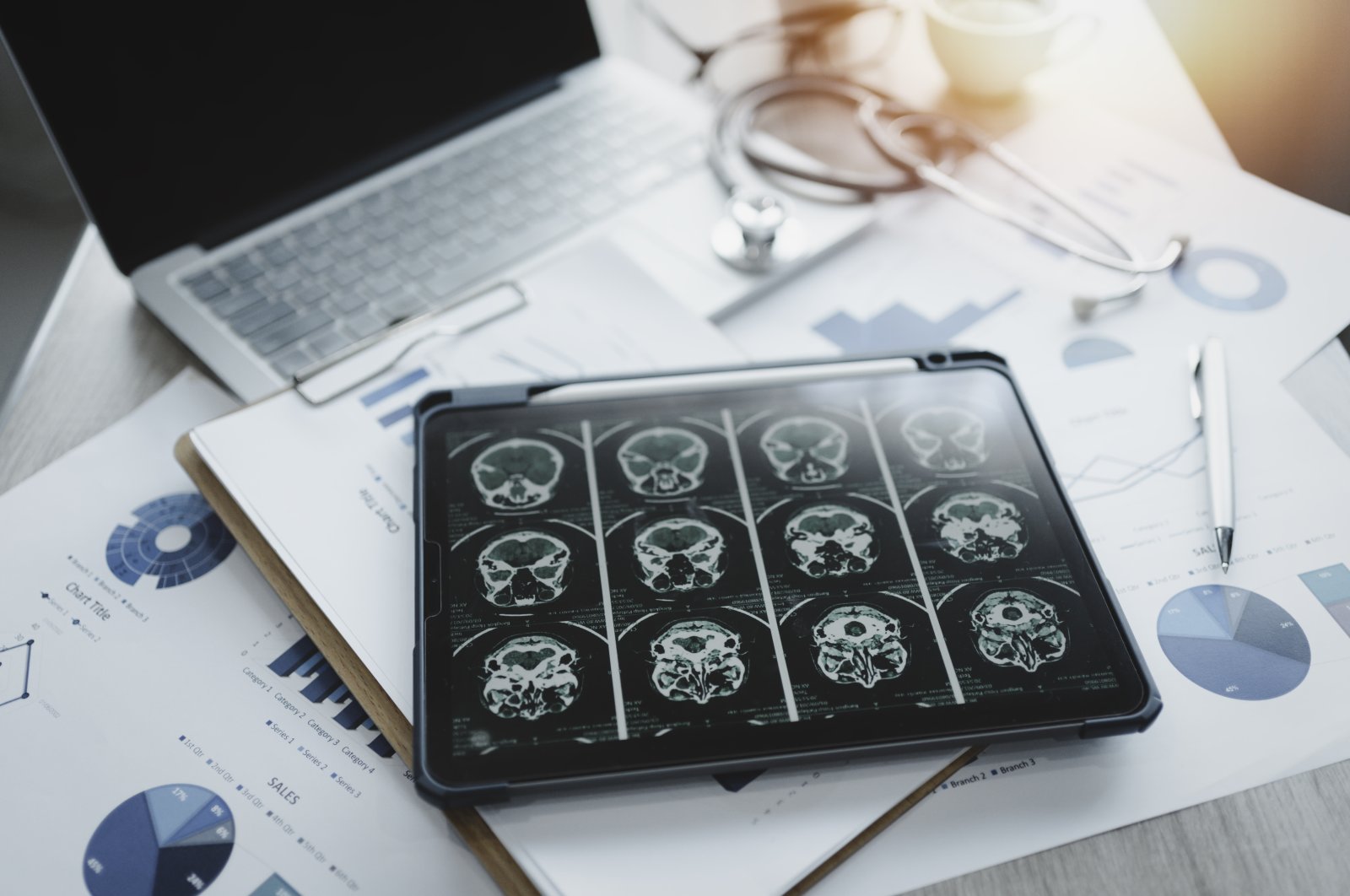 Close-up of a digital tablet displaying a brain X-ray on the screen. (Getty Images)