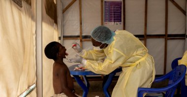 Christian Musema, a laboratory nurse, takes a sample from a child declared a suspected case Mpox at the the treatment center, North Kivu province, DRC, July 19, 2024. (Reuters Photo)