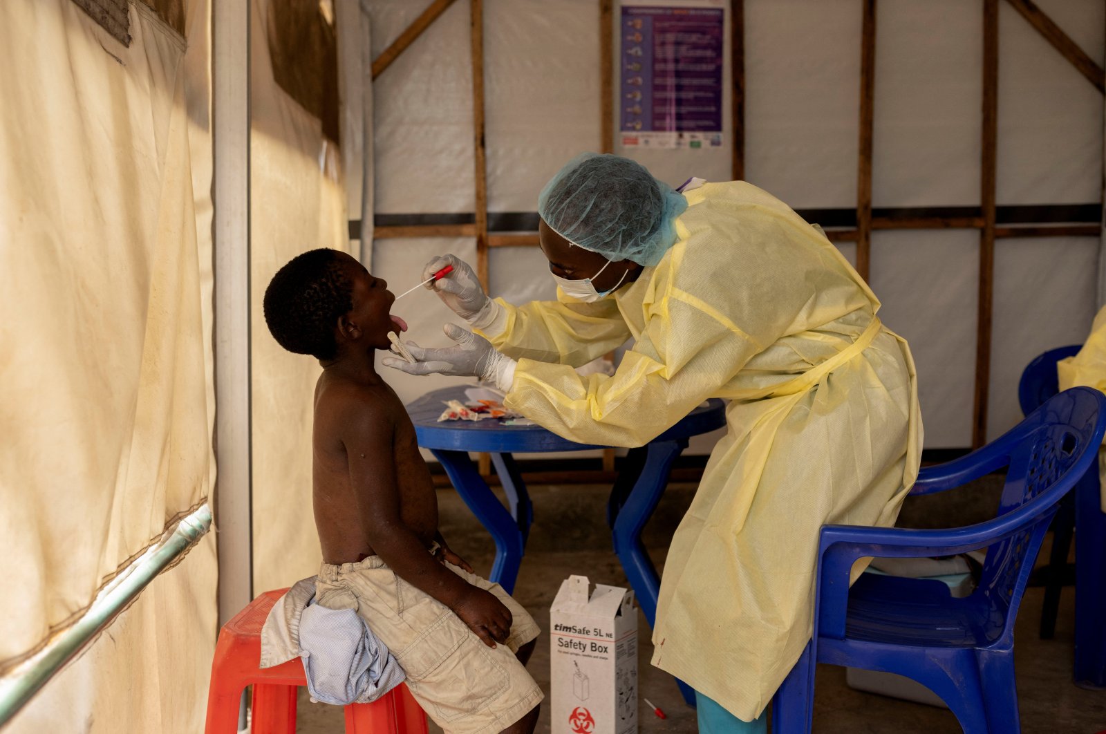 Christian Musema, a laboratory nurse, takes a sample from a child declared a suspected case Mpox at the the treatment center, North Kivu province, DRC, July 19, 2024. (Reuters Photo)