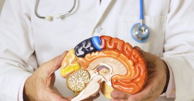 A doctor holds an anatomical model of the brain in his hands. (Getty Images)