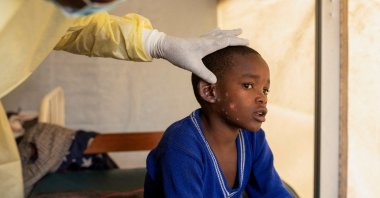 A doctor verifies the evolution of skin lesions on the ear of a boy suffering from mpox at the treatment center in Munigi, Democratic Republic of Congo, July 19, 2024. (Reuters Photo)