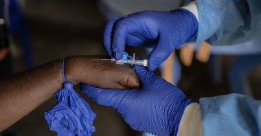 A health worker attends to a mpox patient, at a treatment centre in Munigi, eastern Congo, Aug. 16, 2024. (AP Photo)