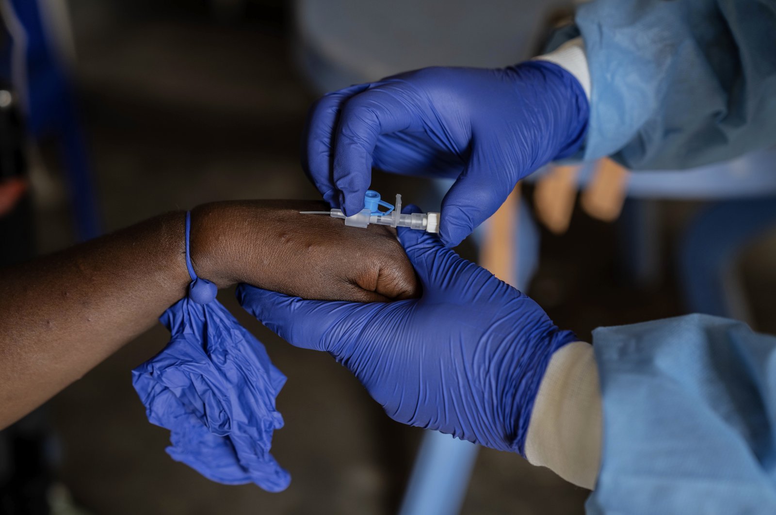 A health worker attends to a mpox patient, at a treatment centre in Munigi, eastern Congo, Aug. 16, 2024. (AP Photo)