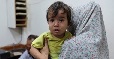 A Palestinian child looks on while being examined by a doctor at Al-Aqsa Martyrs Hospital, amid fears over the spread of polio after the first case was reported by the Ministry of Health, Deir al-Balah, Gaza Strip, Palestine, Aug. 18, 2024. (Reuters Photo)