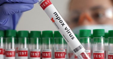 Mpox is a viral disease with symptoms including fever and a distinctive rash. (Reuters Photo)