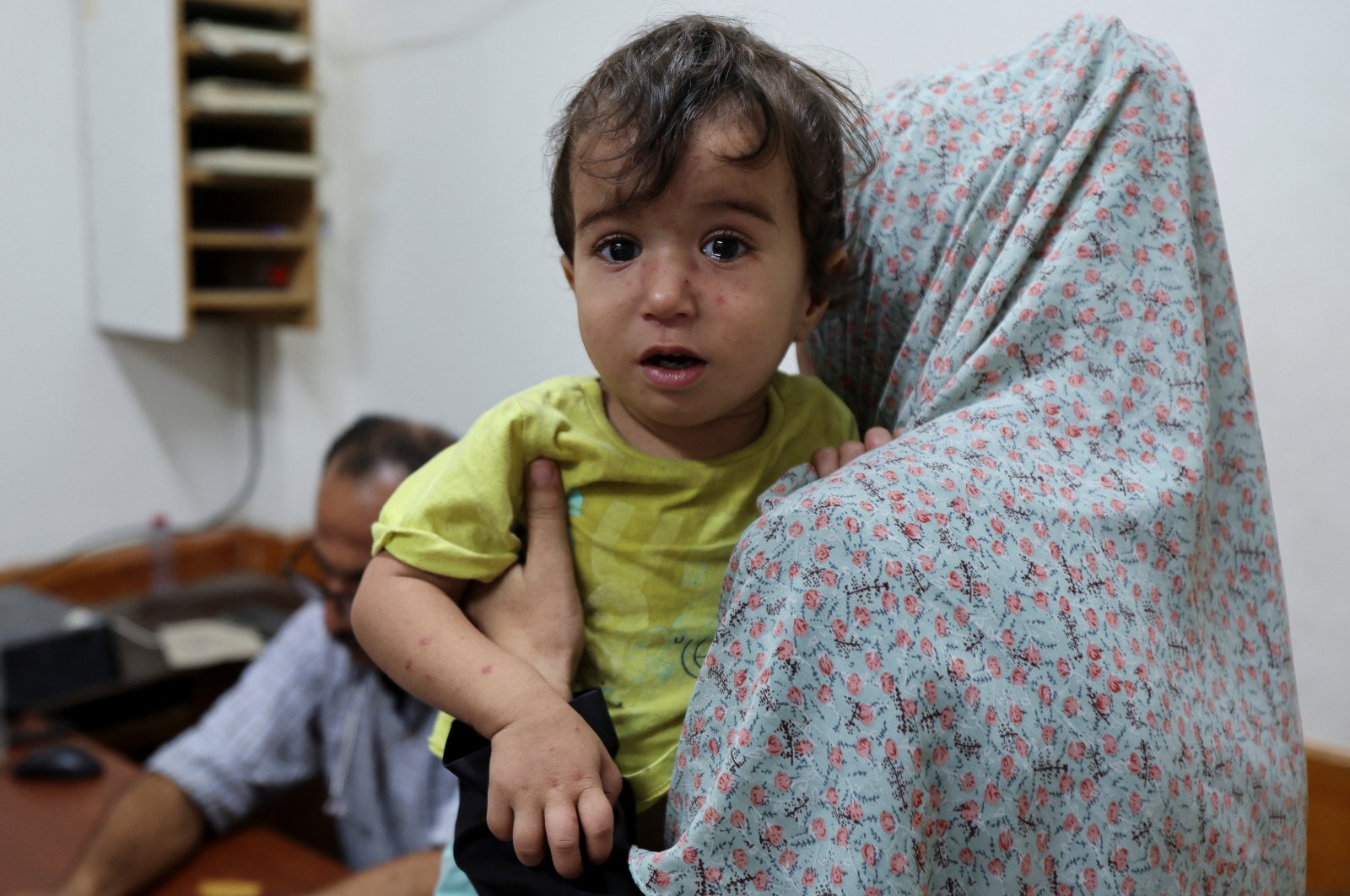 A Palestinian child looks on while being examined by a doctor at Al-Aqsa Martyrs Hospital, amid fears over the spread of polio after the first case was reported by the Ministry of Health, Deir al-Balah, Gaza Strip, Palestine, Aug. 18, 2024. (Reuters Photo)