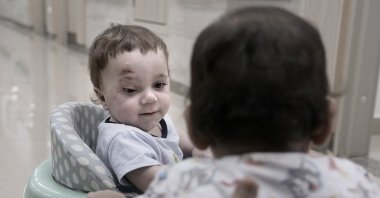Ten-month-old Palestinian Mostafa Youssef Qadoura, who was badly injured during the war in Gaza, plays at the New Administrative Capital Hospital, Cairo, Egypt, Aug. 14, 2024. (AP Photo)