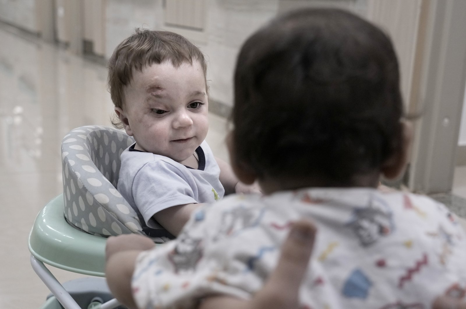 Ten-month-old Palestinian Mostafa Youssef Qadoura, who was badly injured during the war in Gaza, plays at the New Administrative Capital Hospital, Cairo, Egypt, Aug. 14, 2024. (AP Photo)