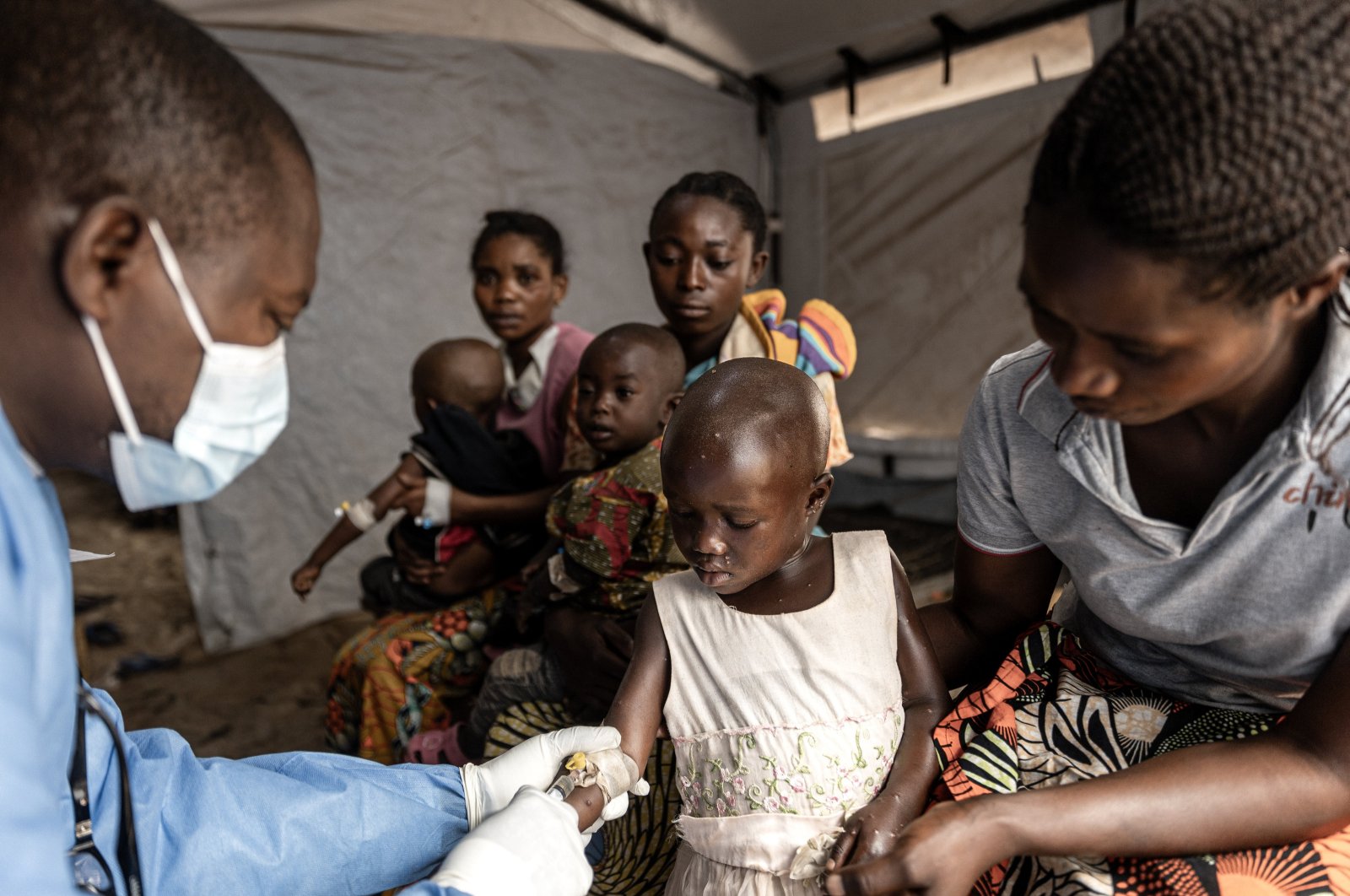 A young Mpox patient receives treatment at the Kavumu hospital in Karanrhada, Kamavu, South Kivu province, DRC, Sept. 3, 2024. (EPA Photo)