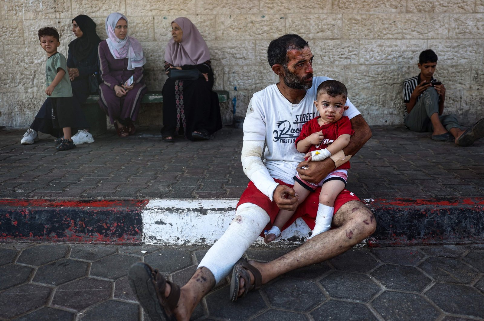 Palestinian Ahmad Yunis and his 3-year-old son Sami, both injured in an Israeli bombing, sit outside the Al-Aqsa Martyrs Hospital, in Deir al-Balah, in the central Gaza Strip, Sept. 8, 2024. (AFP Photo)