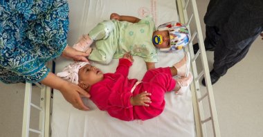 The separated children at the Bilkent City Hospital, Ankara, Türkiye, Sept. 6, 2024. (AA Photo)