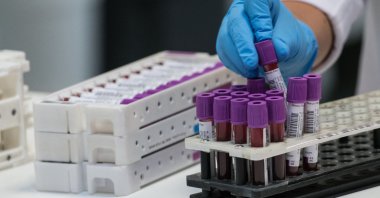 A laboratory technician organizes blood samples before carrying out a COVID-19 screening test at the LPA medical analysis laboratory, Besancon, eastern France, May 29, 2020. (AFP Photo)