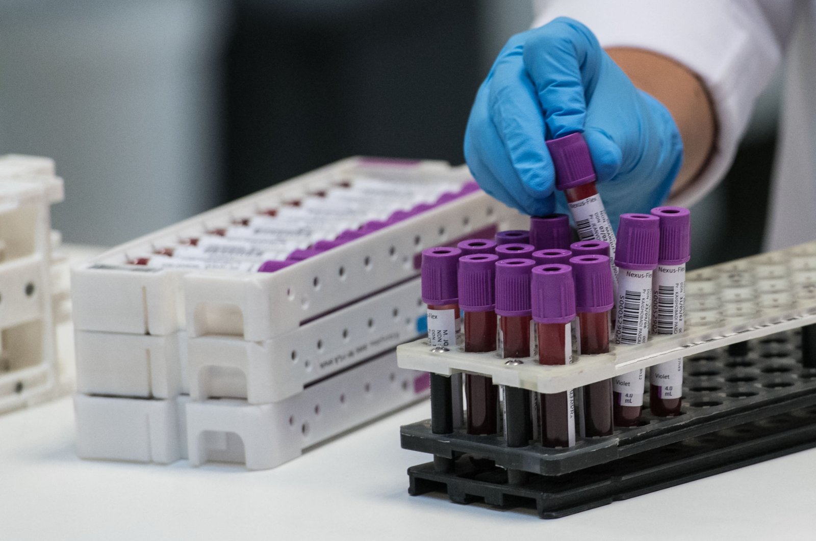 A laboratory technician organizes blood samples before carrying out a COVID-19 screening test at the LPA medical analysis laboratory, Besancon, eastern France, May 29, 2020. (AFP Photo)