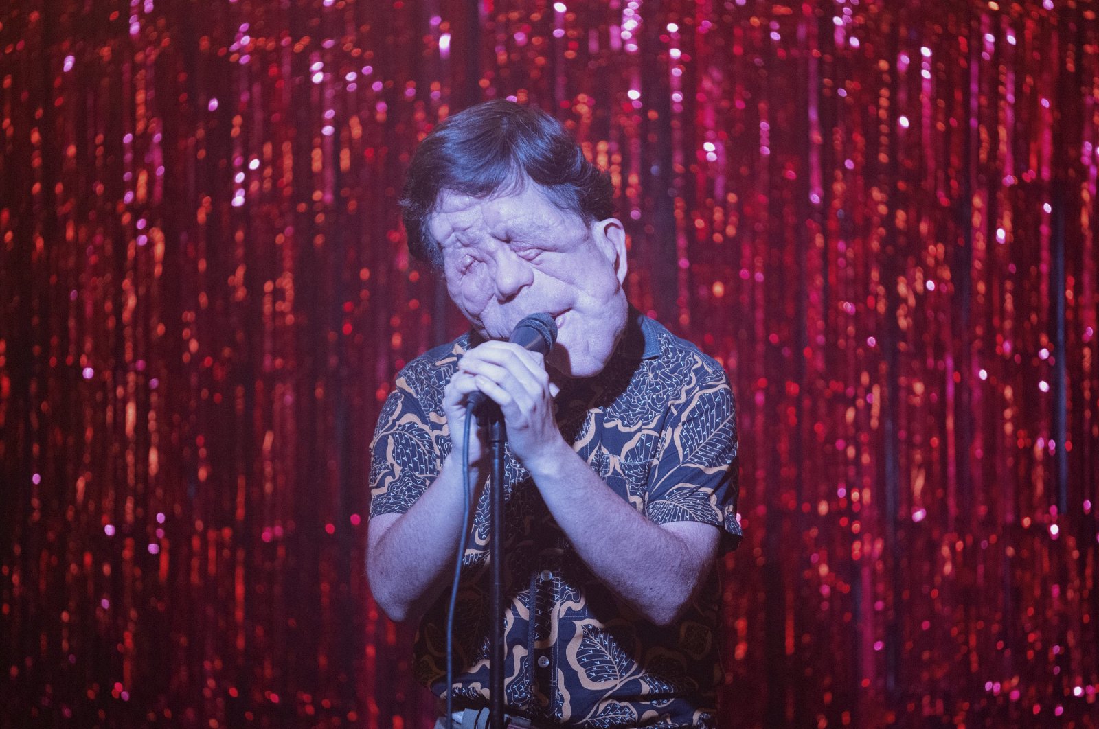 This image released by A24 shows Adam Pearson in a scene from &quot;A Different Man.&quot; (AP Photo)