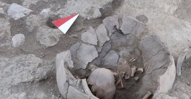 A 6,000-year-old shaped skull in Yassıhöyük, Kahramanmaraş, Türkiye, Aug. 13, 2024. (AA Photo)
