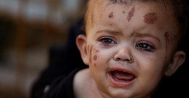 Reem Abu Haya, a Palestinian girl who survived an Israeli strike that killed her entire family, cries at Nasser hospital, Khan Younis, southern Gaza Strip, Aug. 13, 2024. (Reuters Photo)