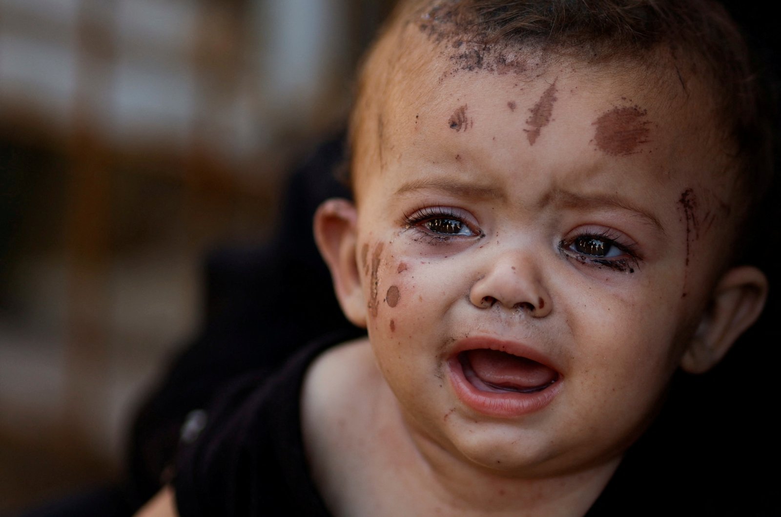 Reem Abu Haya, a Palestinian girl who survived an Israeli strike that killed her entire family, cries at Nasser hospital amid the Israel-Hamas conflict, Khan Younis, southern Gaza Strip, Aug. 13, 2024. (Reuters Photo)