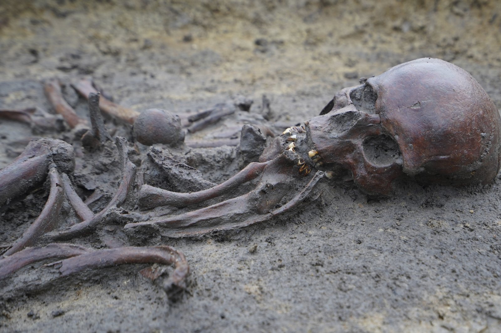 Skeletons and skulls sit in graves at an excavation site of a 10th-century Viking burial ground, Aasum, Denmark, Oct. 7, 2024. (AP Photo)